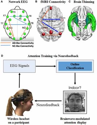 Tuning Up the Old Brain with New Tricks: Attention Training via Neurofeedback